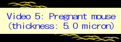 Video 5: Pregnant mouse (thickness: 5.0 micron)